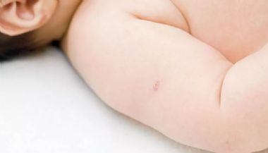 Cuiabá irá retomar vacinação da BCG em crianças; veja locais